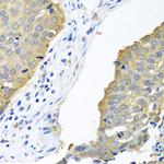 eIF4E Antibody in Immunohistochemistry (Paraffin) (IHC (P))