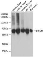 ETFDH Antibody in Western Blot (WB)