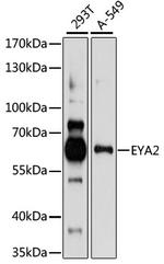 EYA2 Antibody in Western Blot (WB)