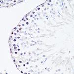 FGF12 Antibody in Immunohistochemistry (Paraffin) (IHC (P))