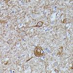 FKBP1B Antibody in Immunohistochemistry (Paraffin) (IHC (P))