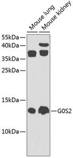 G0S2 Antibody in Western Blot (WB)