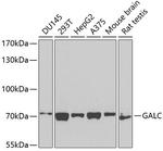 GALC Antibody in Western Blot (WB)