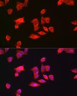 GAMT Antibody in Immunocytochemistry (ICC/IF)