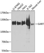 GART Antibody in Western Blot (WB)