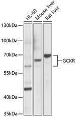 GCKR Antibody in Western Blot (WB)