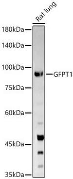 GFPT1 Antibody in Western Blot (WB)