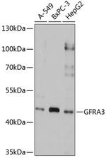 GFR alpha-3 Antibody in Western Blot (WB)