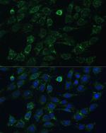 GK2 Antibody in Immunocytochemistry (ICC/IF)