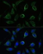 GK2 Antibody in Immunocytochemistry (ICC/IF)