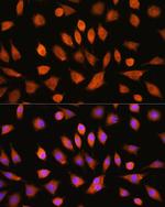 PI4KA Antibody in Immunocytochemistry (ICC/IF)