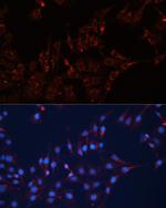 GNAI2 Antibody in Immunocytochemistry (ICC/IF)