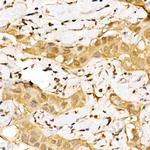 GPS1 Antibody in Immunohistochemistry (Paraffin) (IHC (P))