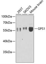 GPS1 Antibody in Western Blot (WB)