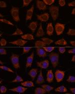 GRHPR Antibody in Immunocytochemistry (ICC/IF)