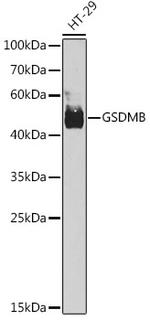 GSDMB Antibody in Western Blot (WB)