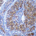 GULP1 Antibody in Immunohistochemistry (Paraffin) (IHC (P))