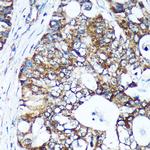 GULP1 Antibody in Immunohistochemistry (Paraffin) (IHC (P))