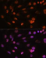 H2AFV Antibody in Immunocytochemistry (ICC/IF)