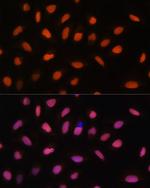 H2AFV Antibody in Immunocytochemistry (ICC/IF)