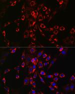 HBEGF Antibody in Immunocytochemistry (ICC/IF)