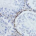 H2BK12ac Antibody in Immunohistochemistry (Paraffin) (IHC (P))