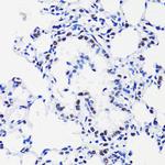 H2BK15ac Antibody in Immunohistochemistry (Paraffin) (IHC (P))