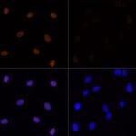 H3K23ac Antibody in Immunocytochemistry (ICC/IF)