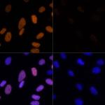 H3K23ac Antibody in Immunocytochemistry (ICC/IF)