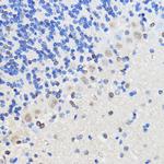 HNRNPU Antibody in Immunohistochemistry (Paraffin) (IHC (P))