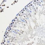 HNRNPU Antibody in Immunohistochemistry (Paraffin) (IHC (P))