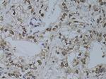 HUS1 Antibody in Immunohistochemistry (Paraffin) (IHC (P))