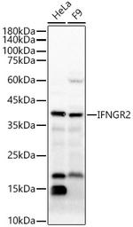 IFNGR2 Antibody in Western Blot (WB)