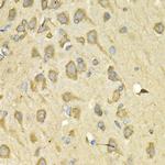 IL10RA Antibody in Immunohistochemistry (Paraffin) (IHC (P))