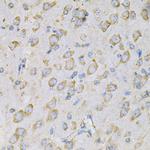 IL10RA Antibody in Immunohistochemistry (Paraffin) (IHC (P))