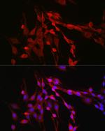 Activin A Antibody in Immunocytochemistry (ICC/IF)