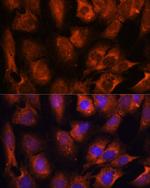 INPP5E Antibody in Immunocytochemistry (ICC/IF)