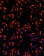 INPP5E Antibody in Immunocytochemistry (ICC/IF)