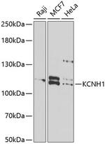 KCNH1 Antibody in Western Blot (WB)