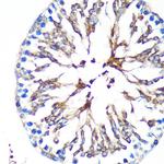 KIF17 Antibody in Immunohistochemistry (Paraffin) (IHC (P))