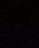 KIF17 Antibody in Immunohistochemistry (Paraffin) (IHC (P))