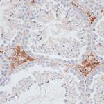 KIFC1 Antibody in Immunohistochemistry (Paraffin) (IHC (P))