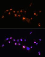 KLF8 Antibody in Immunocytochemistry (ICC/IF)