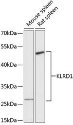 CD94 Antibody in Western Blot (WB)