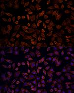 K-Ras Antibody in Immunocytochemistry (ICC/IF)