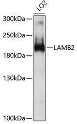 LAMB2 Antibody in Western Blot (WB)