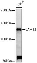 LAMB3 Antibody in Western Blot (WB)