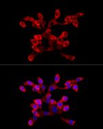 LARP4 Antibody in Immunocytochemistry (ICC/IF)