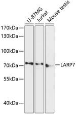 LARP7 Antibody in Western Blot (WB)