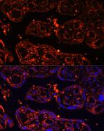 LGR4 Antibody in Immunohistochemistry (Paraffin) (IHC (P))